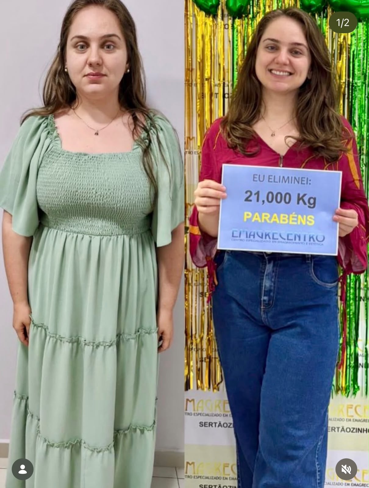 Comparação de antes e depois de uma cliente da Emagrecentro Sertãozinho