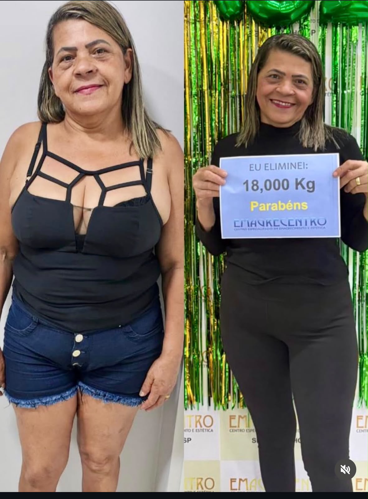 Comparação de antes e depois de uma cliente da Emagrecentro Sertãozinho