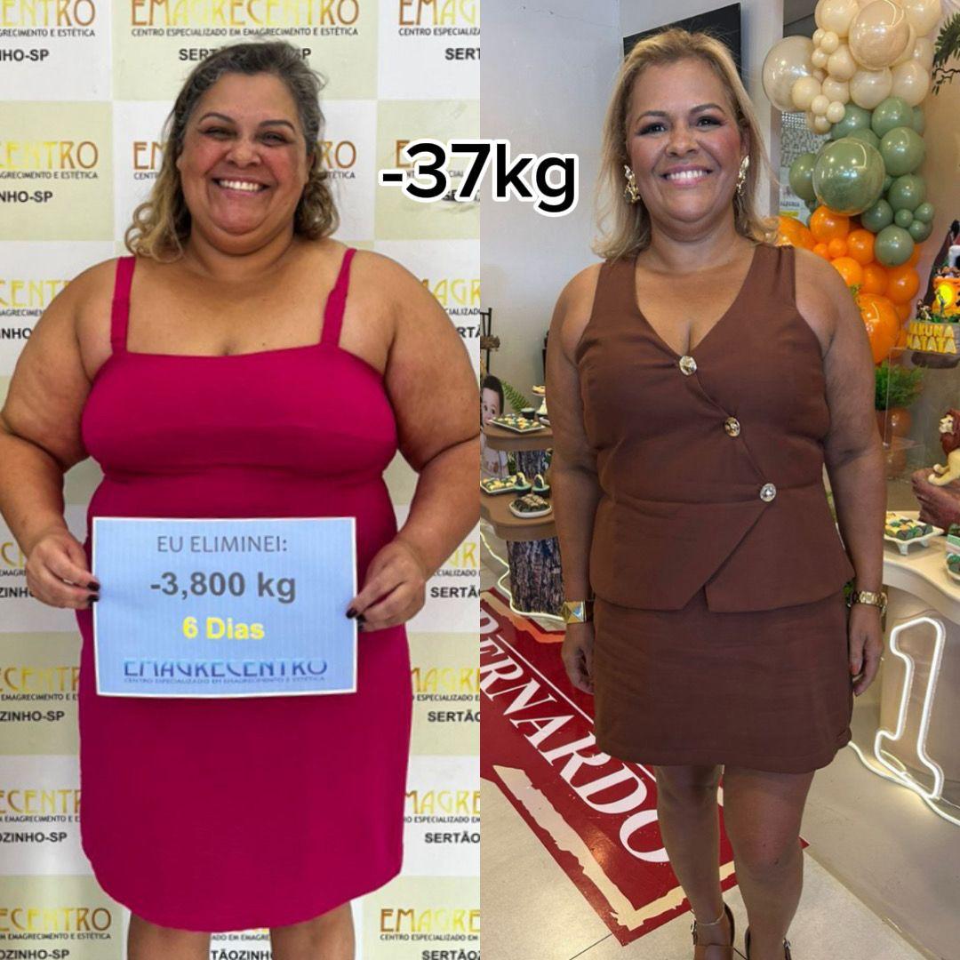 Comparação de antes e depois de uma cliente da Emagrecentro Sertãozinho